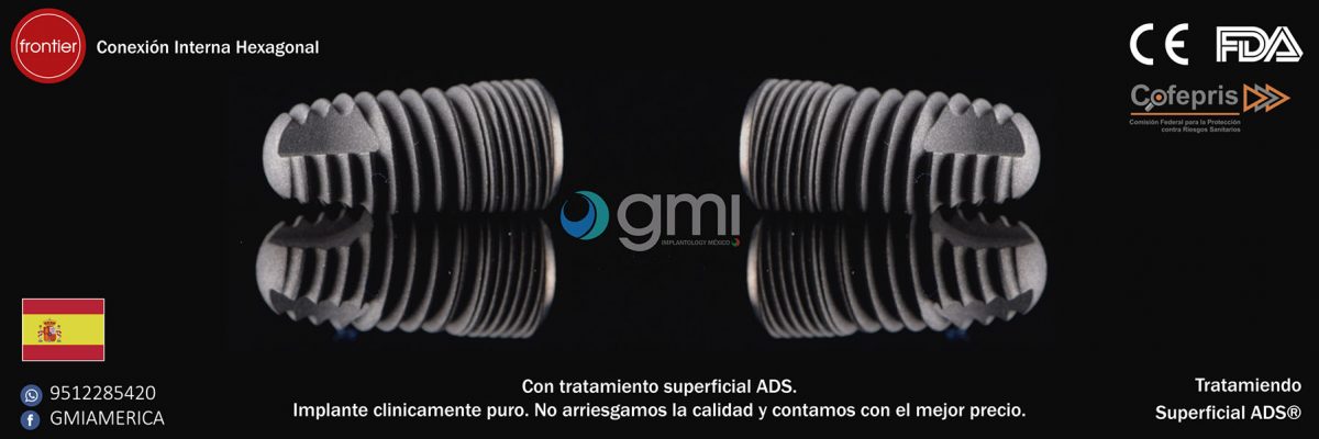 Tu mejor opción..