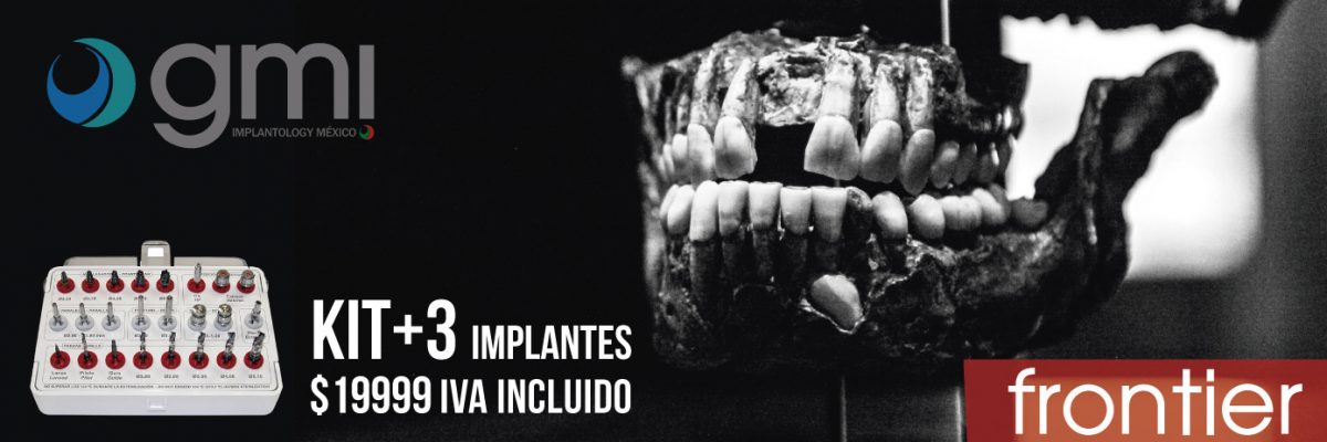 Aprovecha la oferta!